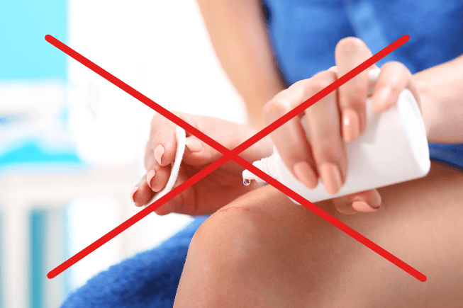Bị Mèo Cắn Ở Đầu Ngón Tay 6 Bị Mèo Cắn Ở Đầu Ngón Tay 6