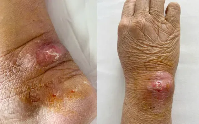 Bị Mèo Cắn Chảy Máu Có Sao Không 1