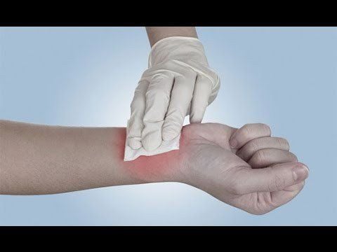 Bị Mèo Cắn Chảy Máu Có Sao Không 9
