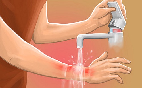 Bị Mèo Cắn Chảy Máu Có Sao Không 8