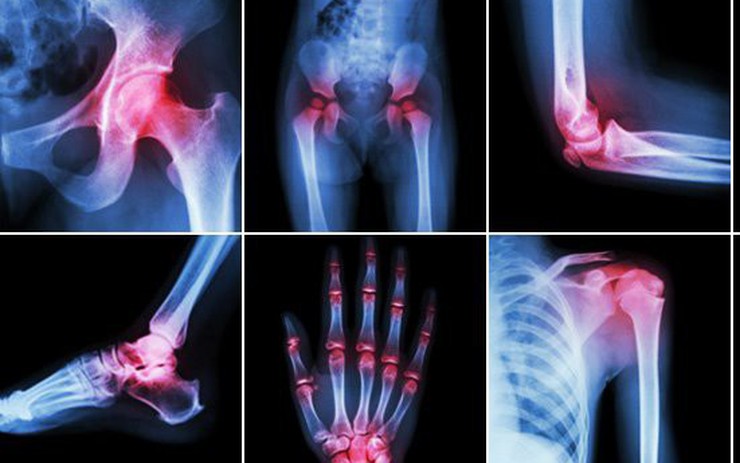 Rượu Hồng Sâm Cao Xương Ngựa 5