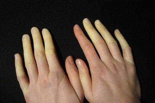 Tác Dụng Của Cao Xương Mèo Đen 9