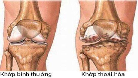Tác Dụng Của Cao Xương Mèo Đen 10