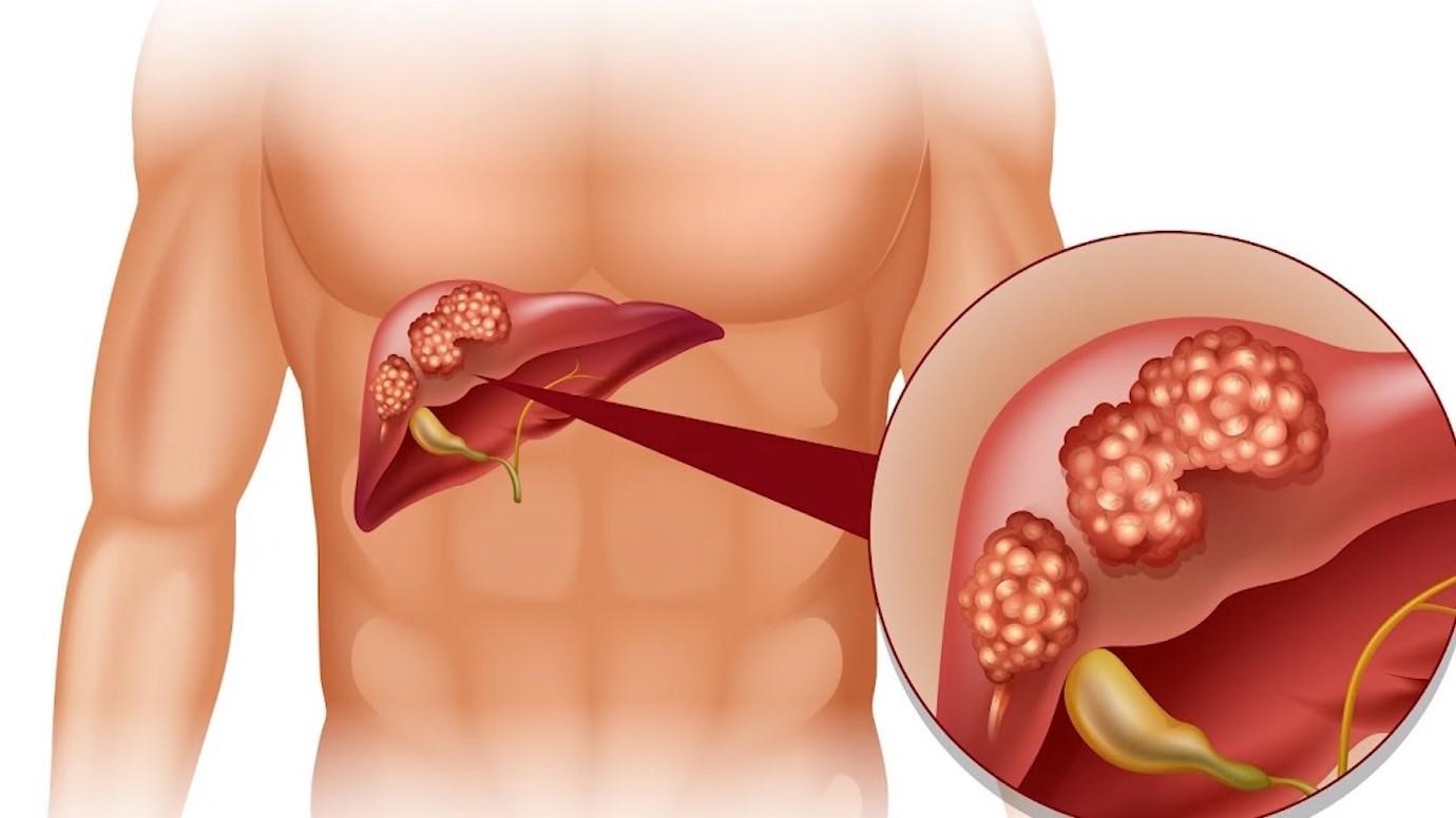 Tác Dụng Của Cao Ngựa Ngâm Rượu 12